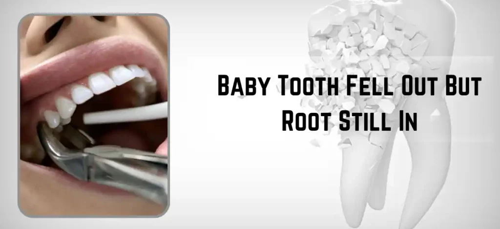 Baby Tooth Fell Out But Root Still In